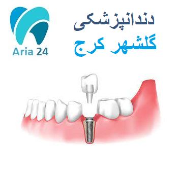 دندانپزشکی در گلشهر کرج